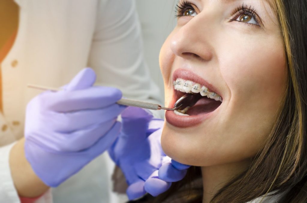 How Much Do Braces Actually Cost? | Orthodontics Of South Miami