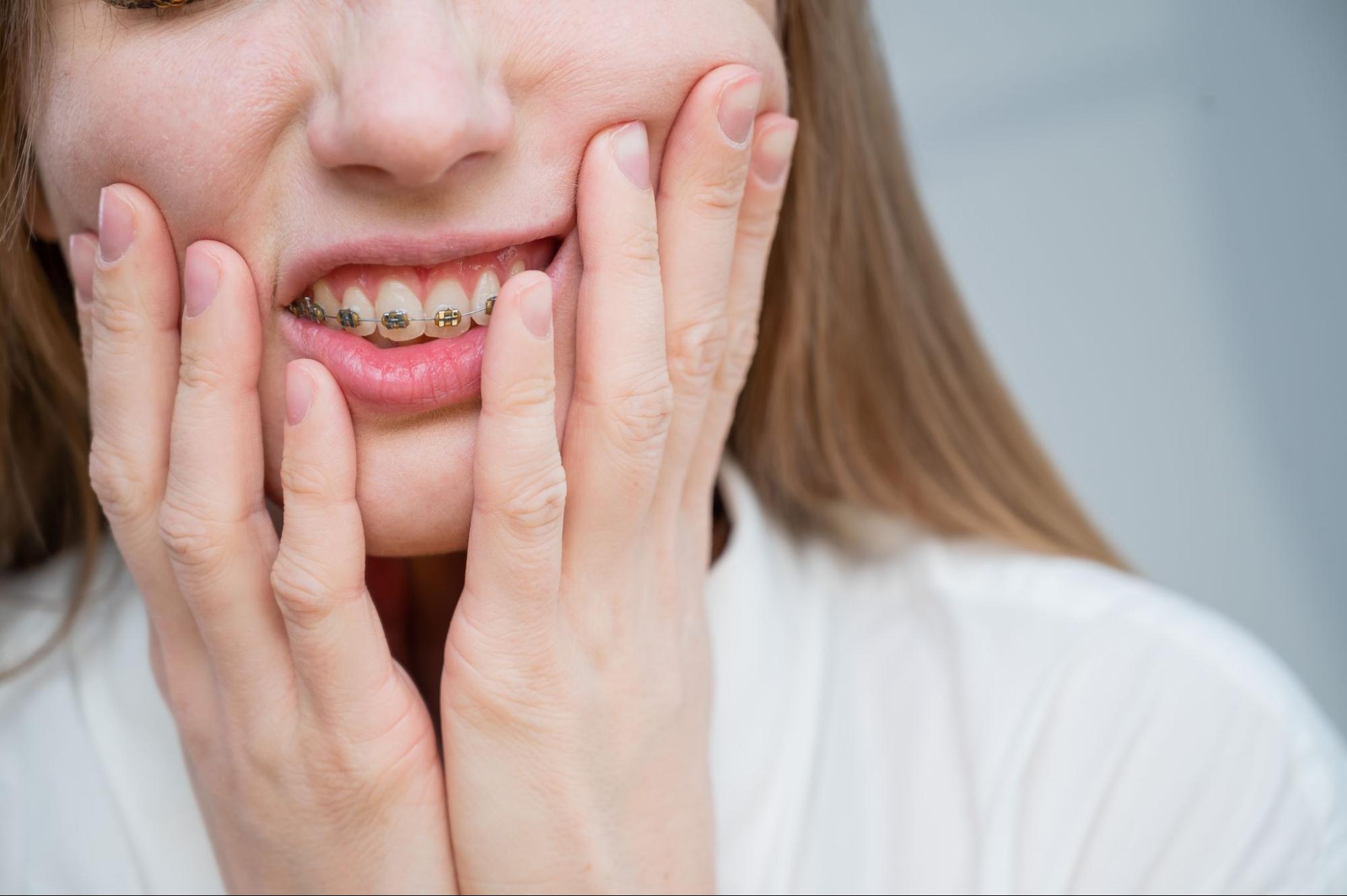 Young woman with braces holding her face, expressing discomfort after tightening appointment, reflecting common braces pain experienced by patients.