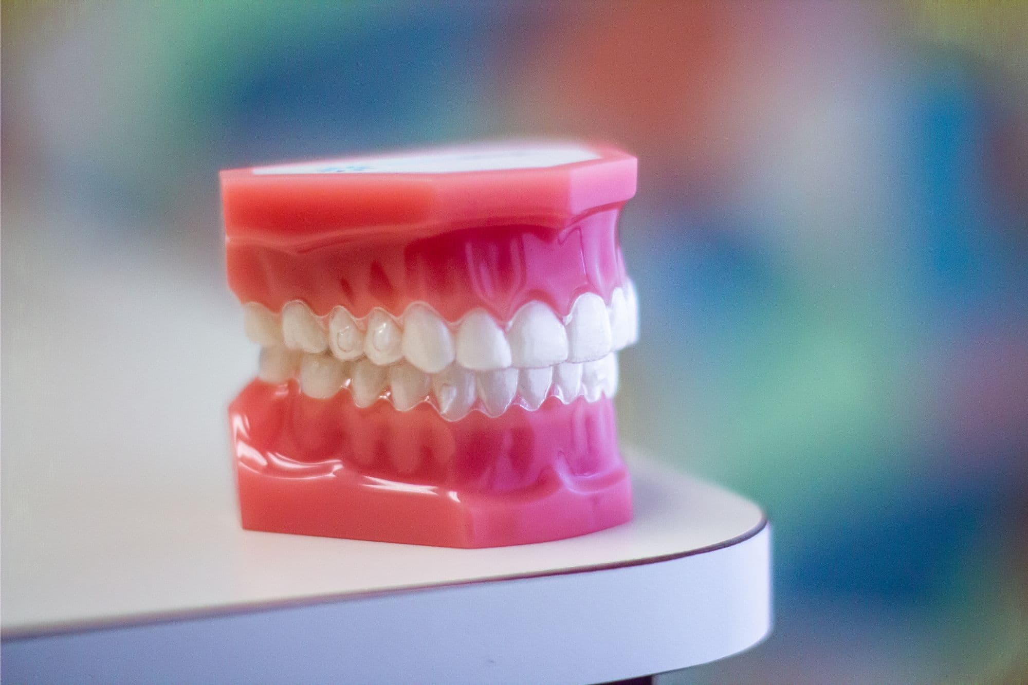 Model of teeth with braces on a dental office table, illustrating orthodontic treatment options for Pinecrest residents.